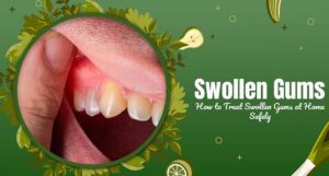 How to treat swollen gums